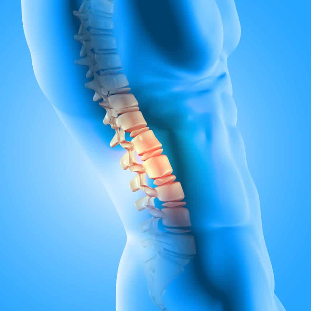 Espondiloartrose - Artrose na Coluna 1 3d render of a male medical figure with spine highlighted