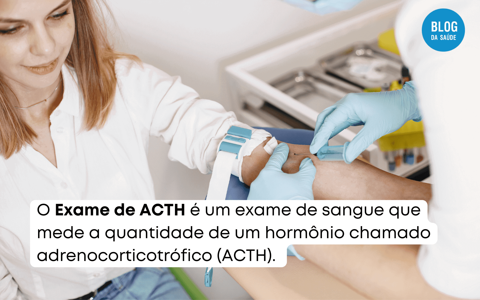 Exame de ACTH