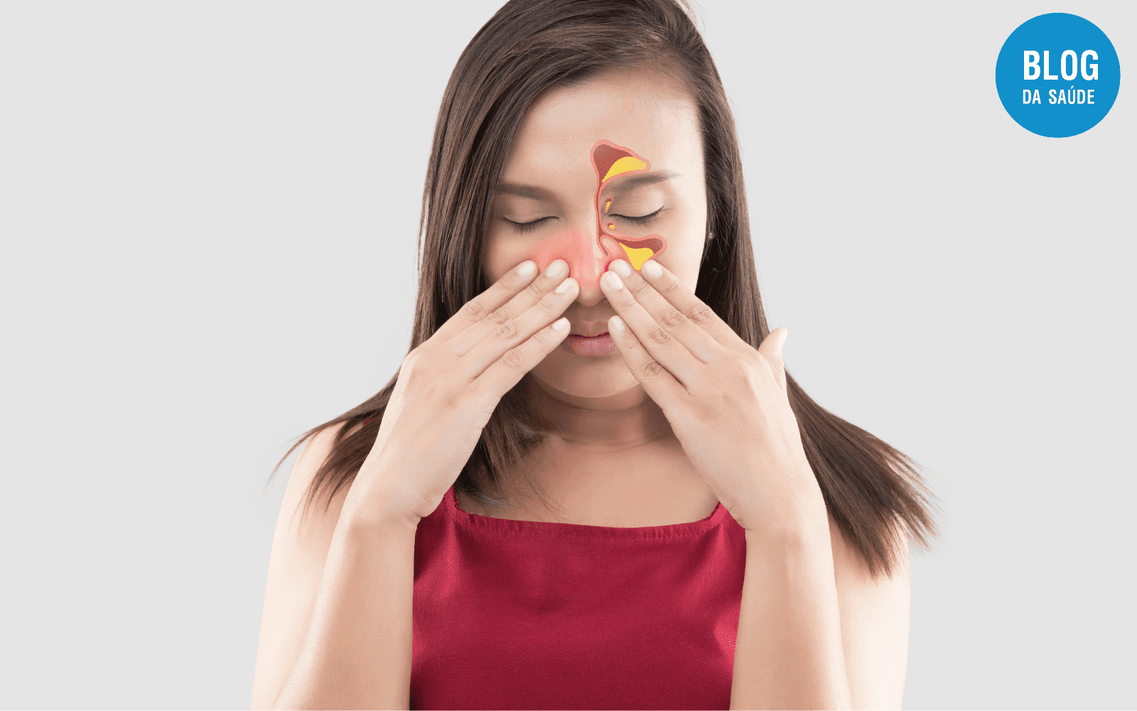 Rinite Medicamentosa