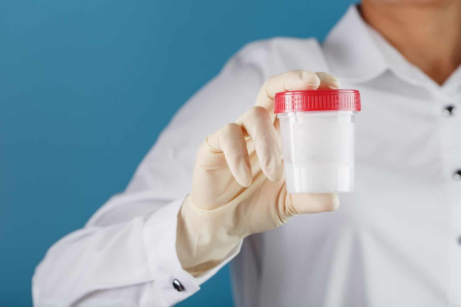 Para que serve exame de fezes? 1 exame de fezes