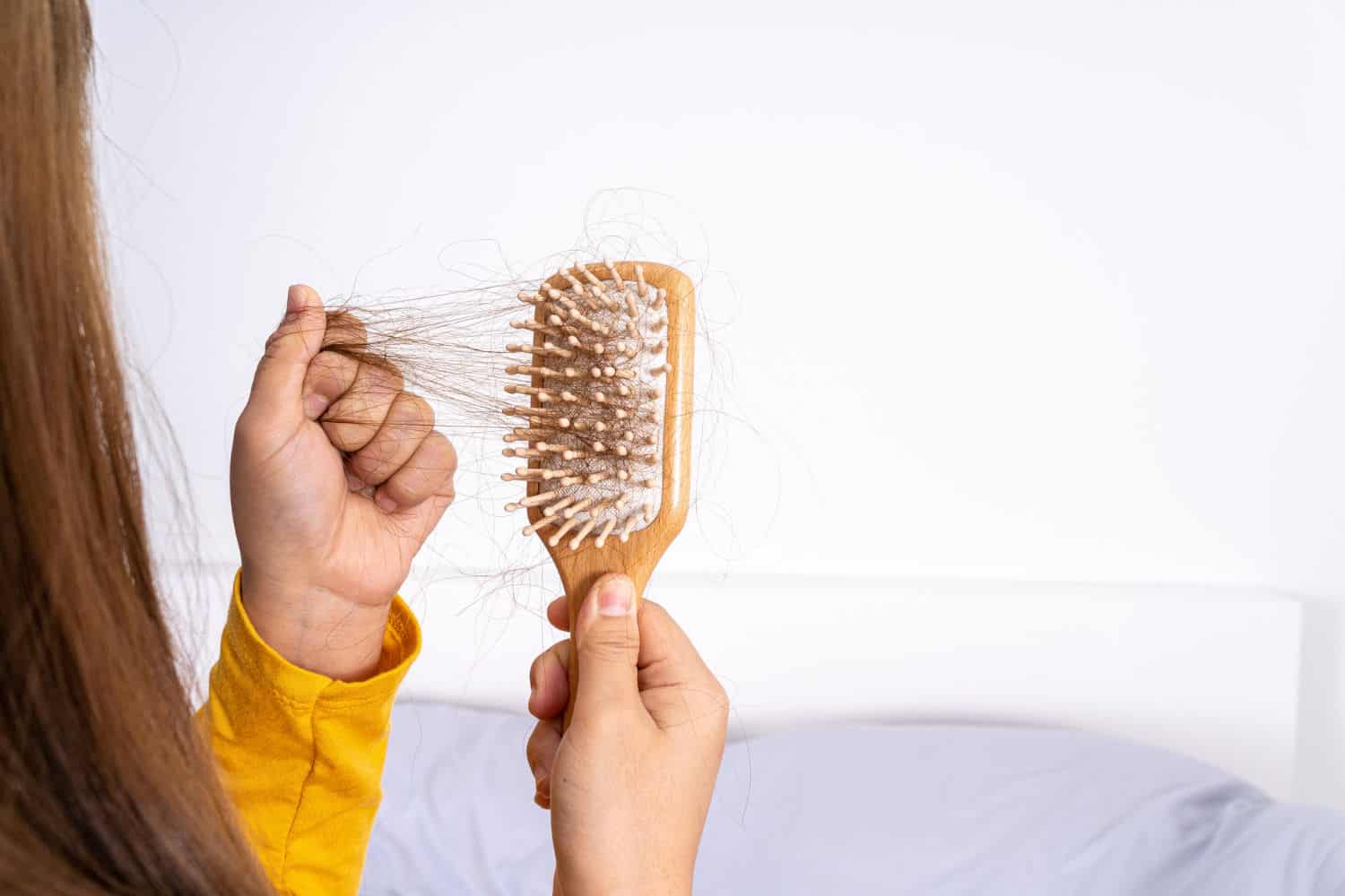 Compreenda As Causas E O Tratamento da Queda de Cabelo Pós-Covid-19 1 hairloss B