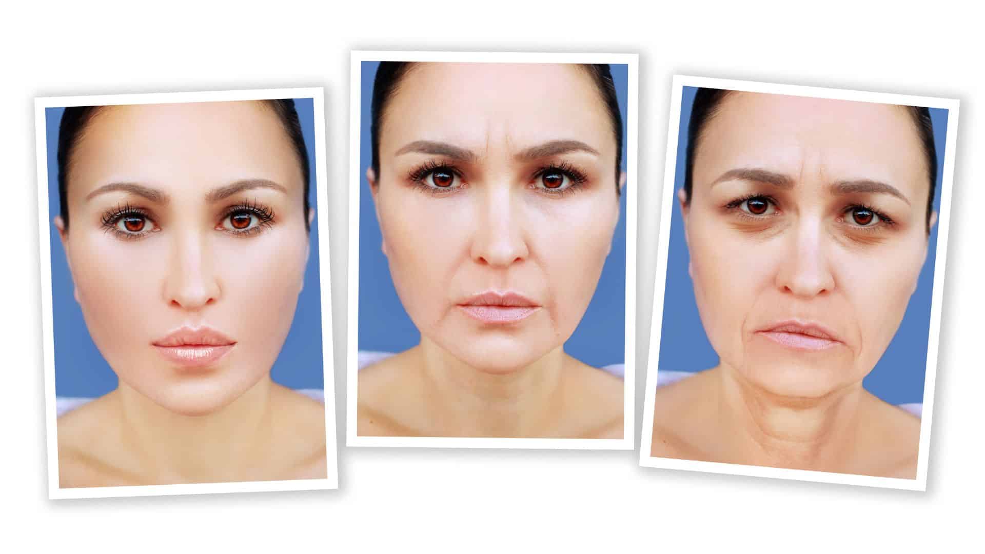 Tratamento para flacidez facial