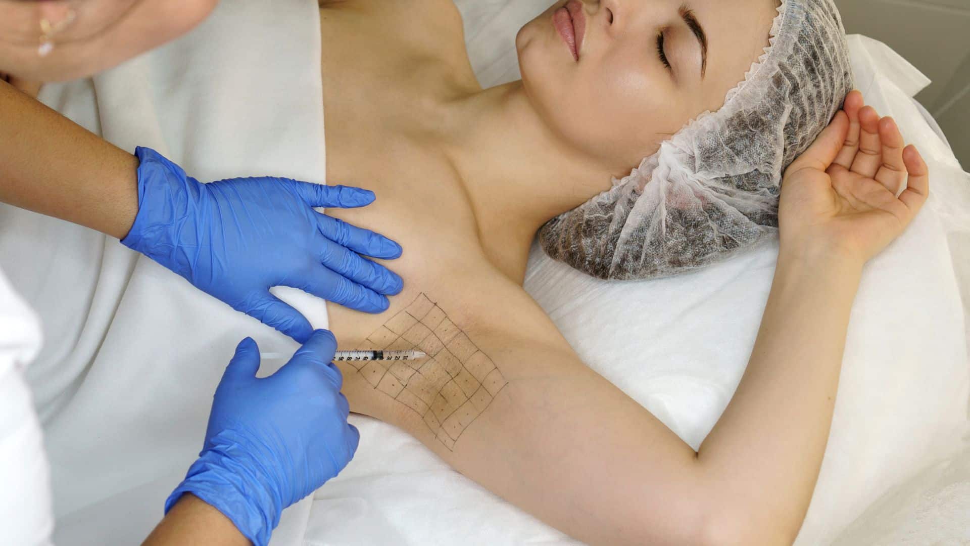 Tratamento para hiperidrose