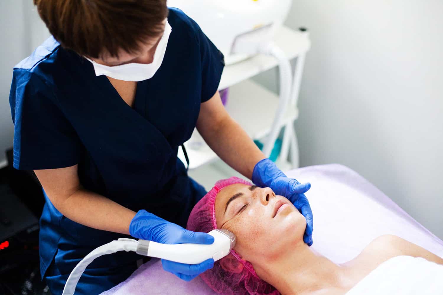 Tratamento de Melasma Com Laser 1 melasma laser