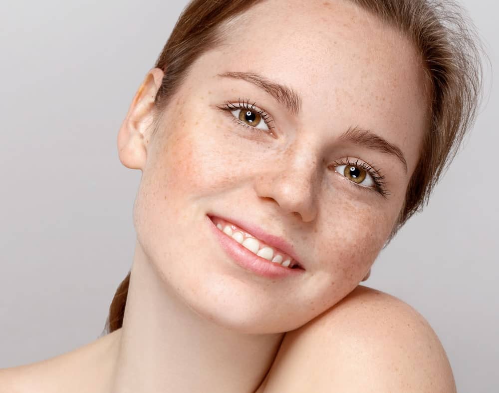 nevo de ota e nevo de ito