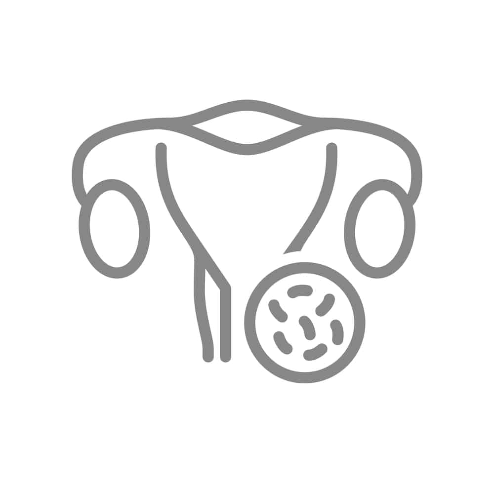 O que significa lactobacillus sp no preventivo? O que significa lactobacillus sp no preventivo?