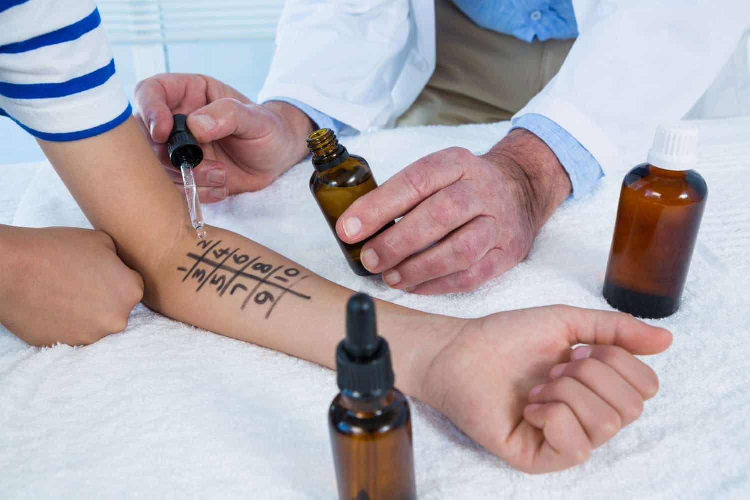 Prick test - Teste de Alergias (Teste Cutâneo) - Aprenda mais 4 prick test