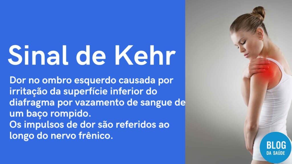 Sinal de Kehr - Dor no ombro por lesão esplênica 2 sinal de kehr