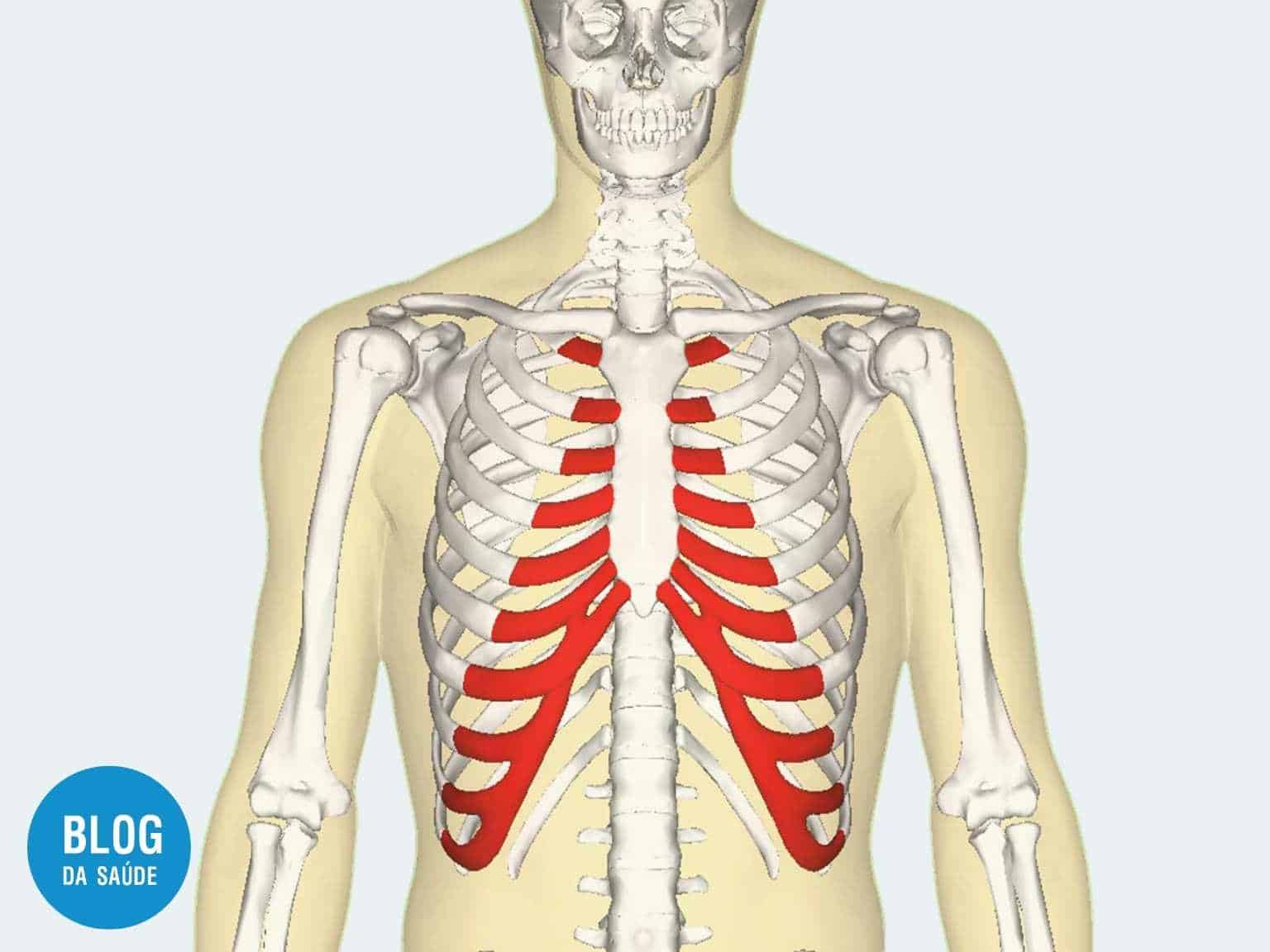 Síndrome de Tietze - O que é? Causas, sintomas e tratamentos 1 sindrome de tietze dor na costela