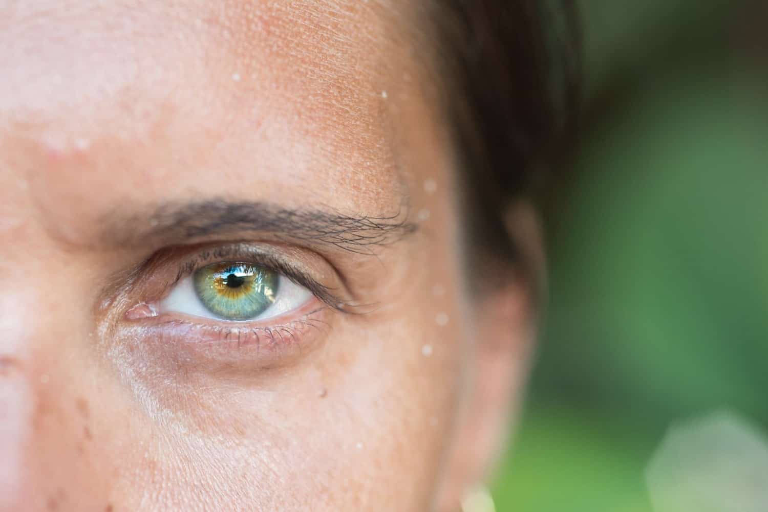 Síndrome do Olho Seco 1 sindrome do olho seco