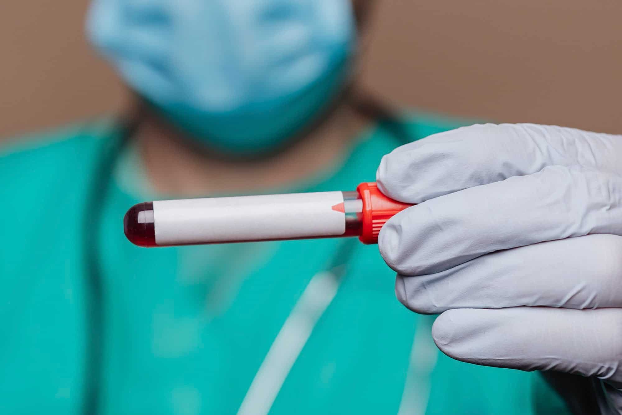 surgeon wearing mask holding blood test tube
