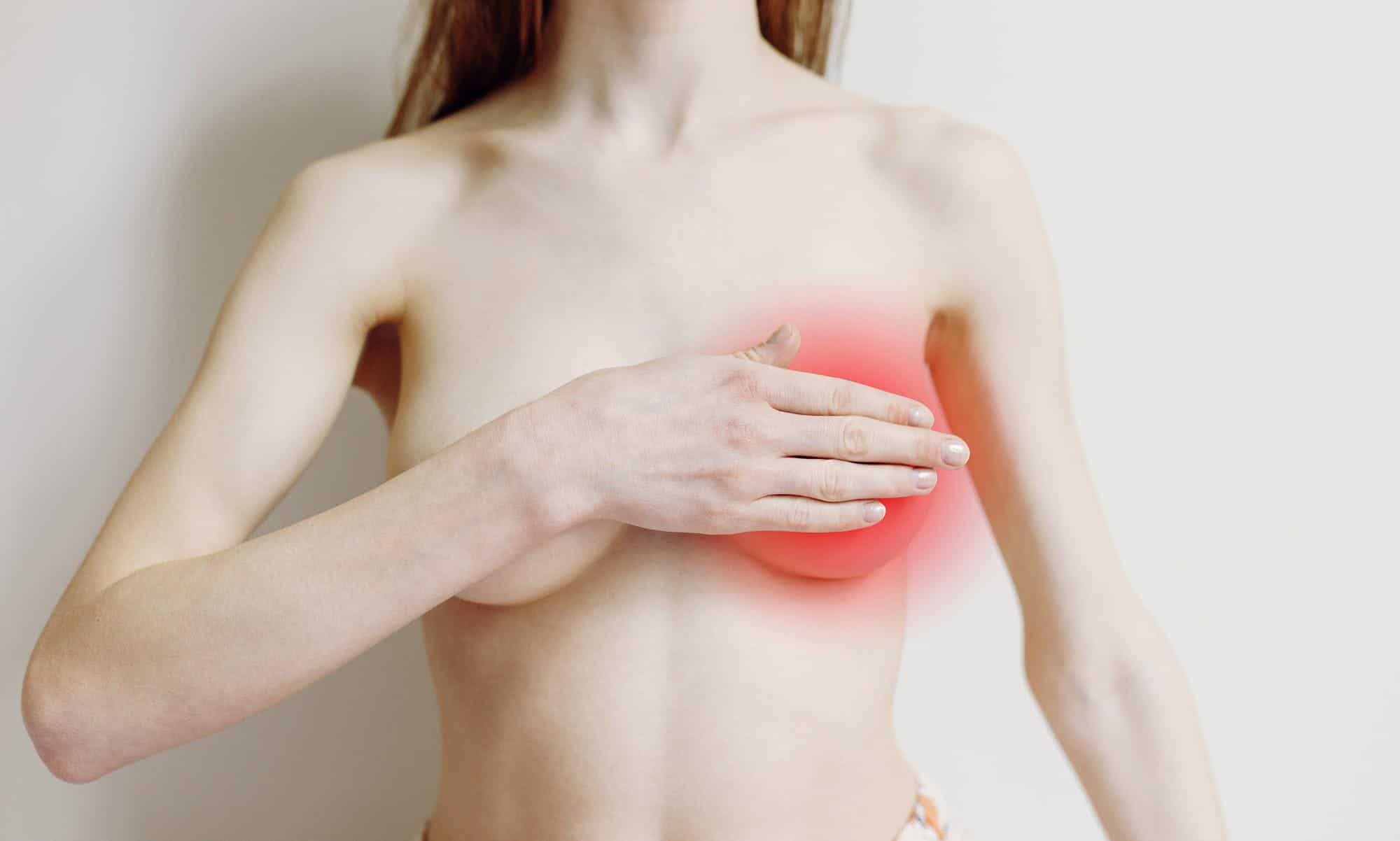 Mancha no Peito - Tipos de Manchas nos seios que podem ser câncer 1 mancha no peito